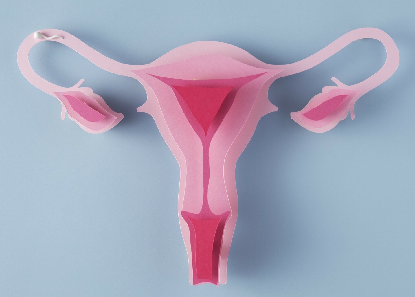 Sterilisation der Frau